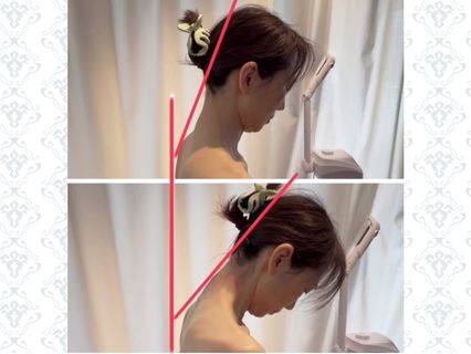 小顔フェイシャル施術をした際のbeforとeafterの様子を女性の横からの写真で比較している