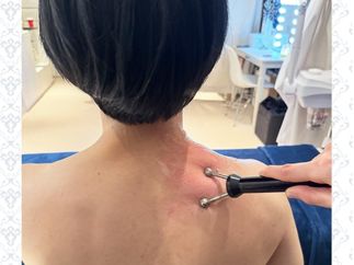 根絶スチーム施術